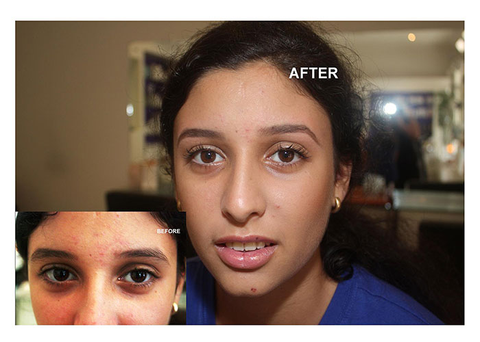Before & After the Elspa Couture Eyebrow service 